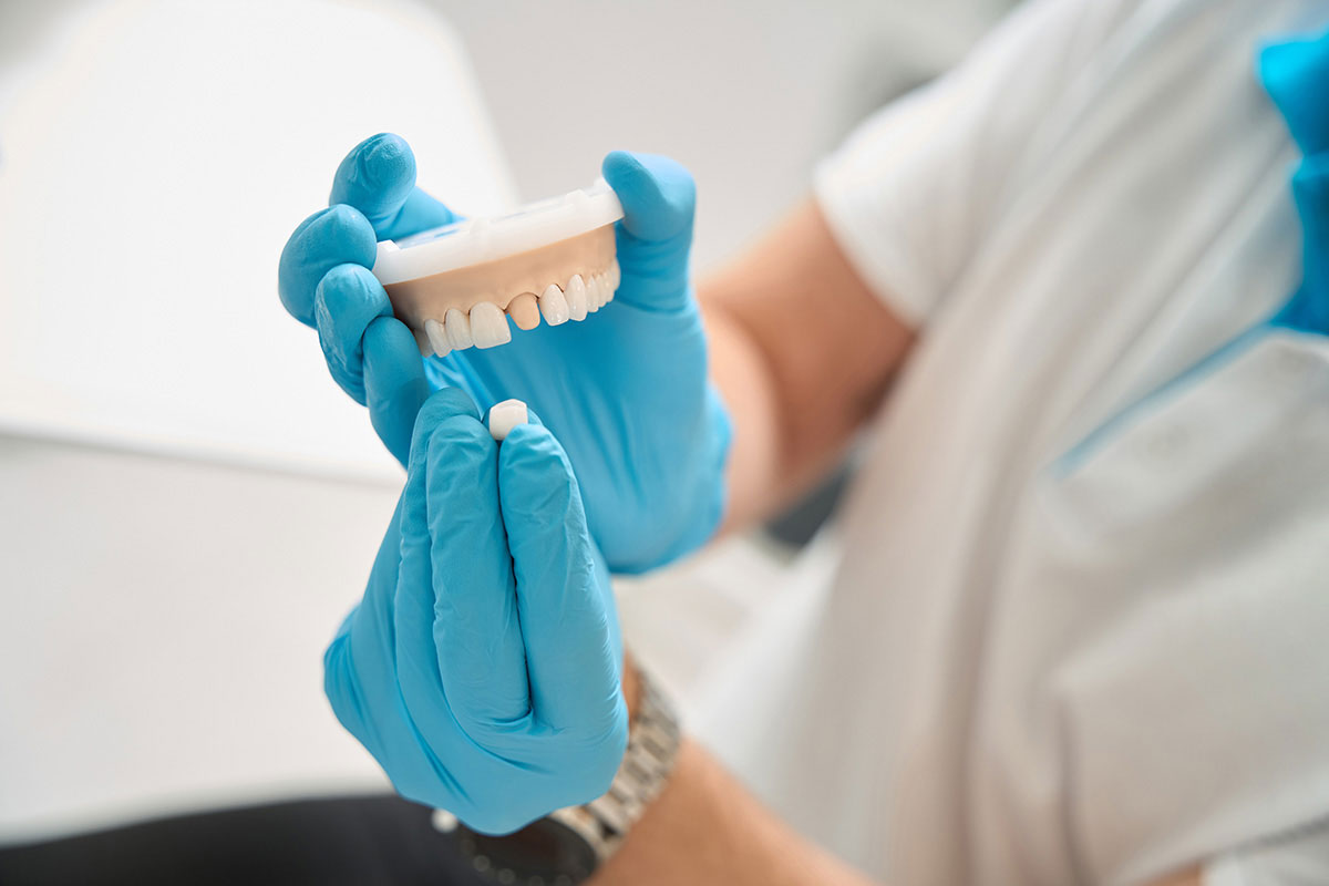 Same-Day Crowns in Houston: Restore a Damaged Tooth in One Visit