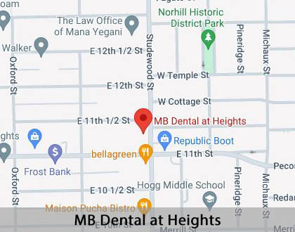 Map image for Partial Denture for One Missing Tooth in Houston, TX